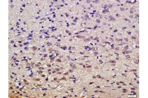 Formalin-fixed and paraffin embedded rat brain labeled with Rabbit Anti-MSK1 (Ser376) Polyclonal Antibody, Unconjugated  at 1:200 followed by conjugation to the secondary antibody and DAB staining (MSK1 抗体  (pSer376))