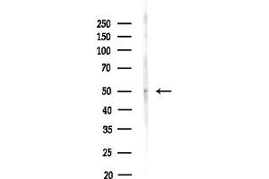 Western blot analysis of lysates from Hela cells(heat-shock,45 min treatment), using ZNF436 Antibody at 1/1000 dilution.