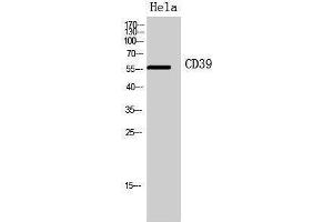 Western Blotting (WB) image for anti-Ectonucleoside Triphosphate diphosphohydrolase 1 (ENTPD1) (Internal Region) antibody (ABIN3178932) (CD39 抗体  (Internal Region))