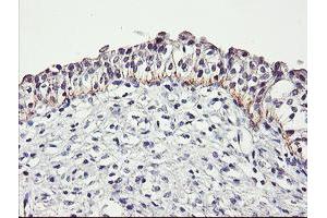 Image no. 2 for anti-Dystrobrevin, beta (DTNB) antibody (ABIN1497913) (Dystrobrevin beta 抗体)