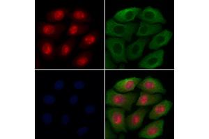 ABIN7094628 and ABIN7098678 staining Hela cells by IF/ICC. (LOXL2 抗体  (Internal Region))