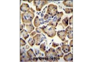 RADIL antibody (C-term) (ABIN654195 and ABIN2844045) immunohistochemistry analysis in formalin fixed and paraffin embedded human pancreas tissue followed by peroxidase conjugation of the secondary antibody and DAB staining. (Radil 抗体  (C-Term))