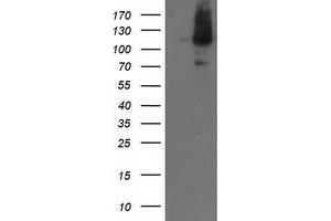 Western Blotting (WB) image for anti-Excision Repair Cross-Complementing Rodent Repair Deficiency, Complementation Group 4 (ERCC4) antibody (ABIN1498071) (ERCC4 抗体)
