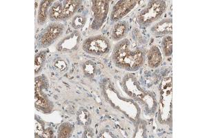 Immunohistochemical staining (Formalin-fixed paraffin-embedded sections) of human kidney with SHOC2 polyclonal antibody  shows moderate cytoplasmic positivity in cells in tubules. (SHoc2/Sur8 抗体  (AA 455-562))