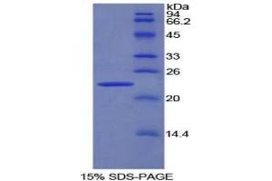 SDS-PAGE analysis of Rat Pronociceptin Protein. (Pronociceptin 蛋白)