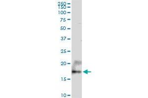 UXT MaxPab polyclonal antibody. (UXT 抗体  (AA 1-169))