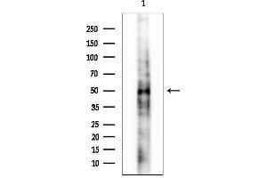 Western blot analysis of lysates from Rat muscle, using Cathepsin D Mouse Monoclonal Antibody.