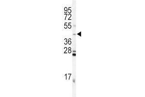 Western Blotting (WB) image for anti-Inhibin, alpha (INHA) antibody (ABIN3002774) (Inhibin alpha 抗体)