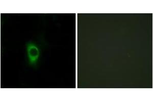 Immunofluorescence analysis of HeLa cells, using 5-HT-2B Antibody. (Serotonin Receptor 2B 抗体  (AA 261-310))