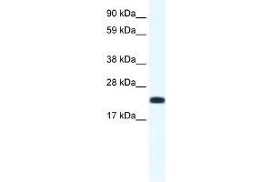 WB Suggested Anti-CITED4 Antibody Titration:  1. (CITED4 抗体  (N-Term))