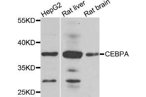 Western blot analysis of extracts of various cells, using CEBPA antibody. (CEBPA 抗体)