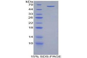 SDS-PAGE (SDS) image for beta-Adrenergic Receptor Kinase (AA 398-640) protein (His tag,GST tag) (ABIN1877156)