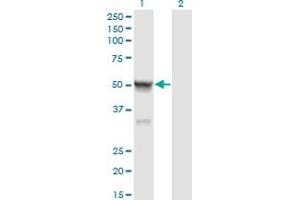 Western Blot analysis of CASQ2 expression in transfected 293T cell line by CASQ2 monoclonal antibody (M01), clone 1B6. (CASQ2 抗体  (AA 20-399))