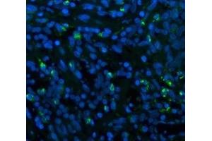 IF analysis of CD68 using anti-CD68 antibody (ABIN7600142).