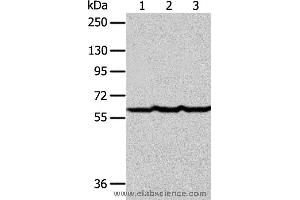 Western blot analysis of Human liver cancer tissue, hela and Jurkat cell , using F9 Polyclonal Antibody at dilution of 1:400 (Coagulation Factor IX 抗体)