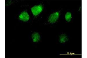 Immunofluorescence of purified MaxPab antibody to ZBTB26 on HeLa cell. (ZBTB26 抗体  (AA 1-441))