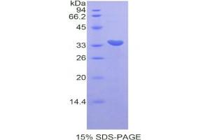 SDS-PAGE analysis of Mouse CDK7 Protein. (CDK7 蛋白)