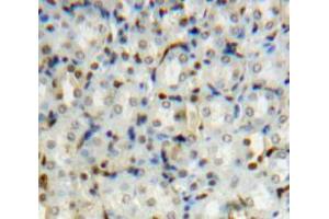 Used in DAB staining on fromalin fixed paraffin-embedded Kidney tissue (PIN1 抗体  (AA 2-163))