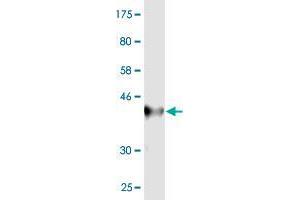 Western Blot detection against Immunogen (36. (IGDCC4 抗体  (AA 1152-1250))