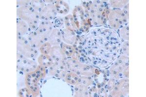 Used in DAB staining on fromalin fixed paraffin- embedded kidney tissue (KNG1 抗体  (AA 19-380))