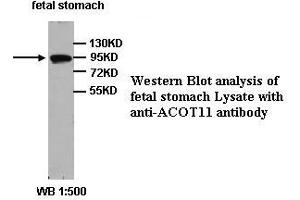 Image no. 1 for anti-Acyl-CoA Thioesterase 11 (ACOT11) (Internal Region) antibody (ABIN791080) (ACOT11 抗体  (Internal Region))