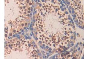 Immunohistochemistry (IHC) image for anti-Carbonic Anhydrase VB, Mitochondrial (CA5B) (AA 63-225) antibody (ABIN7437326)