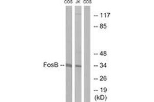 Western blot analysis of extracts from COS7/Jurkat cells, using FosB (Ab-27) Antibody.