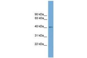 Image no. 1 for anti-Zinc Finger, DHHC-Type Containing 18 (ZDHHC18) (AA 287-336) antibody (ABIN6744728)