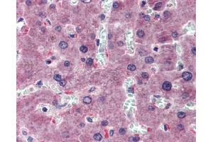 HYAL1 antibody was used for immunohistochemistry at a concentration of 4-8 ug/ml. (HYAL1 抗体  (N-Term))
