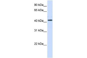 HSD3B2 antibody used at 1 ug/ml to detect target protein. (HSD3B2 抗体  (N-Term))