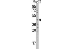 Western Blotting (WB) image for anti-Wnt1 Inducible Signaling Pathway Protein 3 (WISP3) antibody (ABIN3002571) (WISP3 抗体)