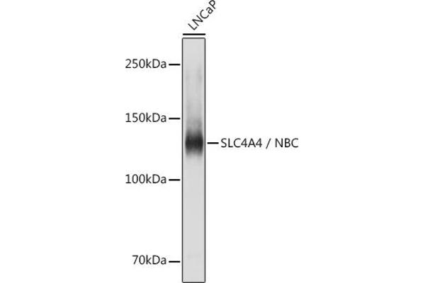 SLC4A4 抗体  (AA 1-240)