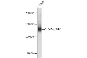 Western blot analysis of extracts of LNCaP cells, using SLC4 / NBC antibody (ABIN6129130, ABIN6148013, ABIN6148014 and ABIN6220962) at 1:1000 dilution. (SLC4A4 抗体  (AA 1-240))