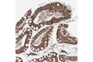 Immunohistochemical staining of human small intestine with TMPRSS11F polyclonal antibody  strong cytoplasmic positivity in glandular cells at 1:50-1:200 dilution. (TMPRSS11F 抗体)