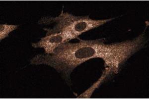 Immunofluorescence staining of WI-38 cells (Human lung fibroblasts, ATCC CCL-75). (SHC1 抗体  (AA 359-473))