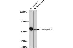 Western blot analysis of extracts of various cell lines, using NONO/p54nrb Rabbit mAb (ABIN7268947) at 1:1000 dilution. (NONO 抗体)