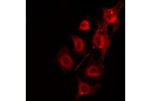 ABIN6266877 staining Hela by IF/ICC. (DMPK 抗体  (N-Term))