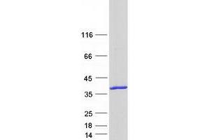 Western Blotting (WB) image for Sulfotransferase Family, Cytosolic, 1A, Phenol-Preferring, Member 2 (SULT1A2) (Transcript Variant 2) protein (Myc-DYKDDDDK Tag) (ABIN2732929)