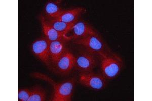 IF analysis of RPS5 using anti-RPS5 antibody (ABIN7599076).