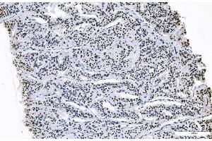 IHC analysis of FOXK1 using anti-FOXK1 antibody (ABIN7600295).