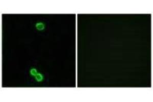 Immunofluorescence analysis of MCF-7 cells, using RPL3L antibody. (RPL3L 抗体)