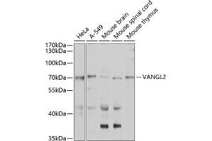 Western blot analysis of extracts of various cell lines, using V antibody (ABIN6132779, ABIN6150054, ABIN6150055 and ABIN6223794) at 1:1000 dilution. (VANGL2 抗体  (AA 1-110))