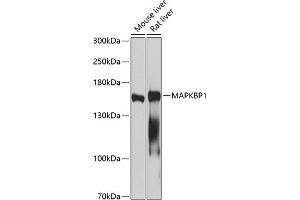 Western blot analysis of extracts of various cell lines, using M antibody (ABIN3016334, ABIN3016335, ABIN5664104 and ABIN6219724) at 1:1000 dilution. (MAPKBP1 抗体  (AA 1-100))