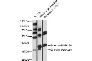 Western blot analysis of extracts of various cells, using Galectin 4/LG antibody (ABIN7267339) at 1:1000 dilution. (GAL4 抗体  (AA 1-100))
