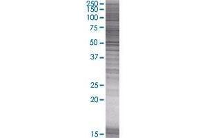 Western Blotting (WB) image for ENTPD1 293T Cell Transient Overexpression Lysate(Denatured) (ABIN1331256)