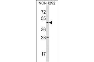 Western blot analysis in NCI-H292 cell line lysates (35ug/lane). (Actl7b 抗体  (N-Term))