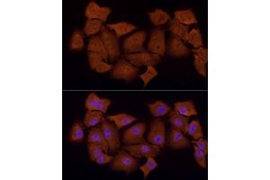 Immunofluorescence analysis of A-549 cells using PSMC5 Rabbit mAb (ABIN7269585) at dilution of 1:50 (40x lens). (PSMC5 抗体)