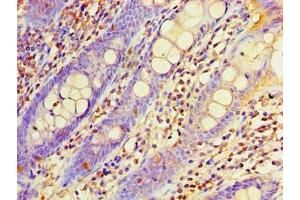Immunohistochemistry of paraffin-embedded human colon tissue using ABIN7162957 at dilution of 1:100 (EHHADH 抗体  (AA 1-723))