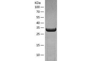 Western Blotting (WB) image for Activator of HSP90 ATPase Activity 1 (AHSA1) (AA 1-338) protein (His tag) (ABIN7121672)