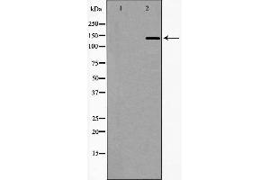Western blot analysis of extracts of Jurkat, using DCTN1 antibody. (Dynactin 1 抗体  (C-Term))